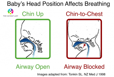 Baby Head Position Affects Breathing